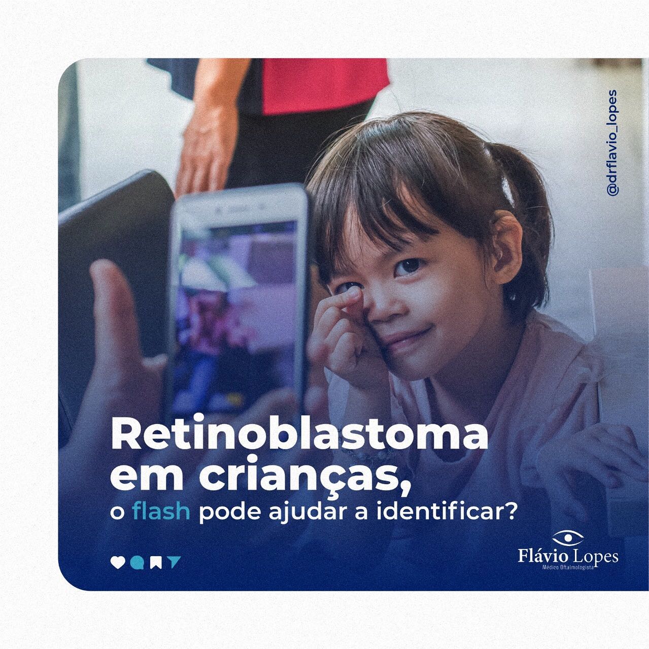 O que é Retinoblastoma? Você sabe?