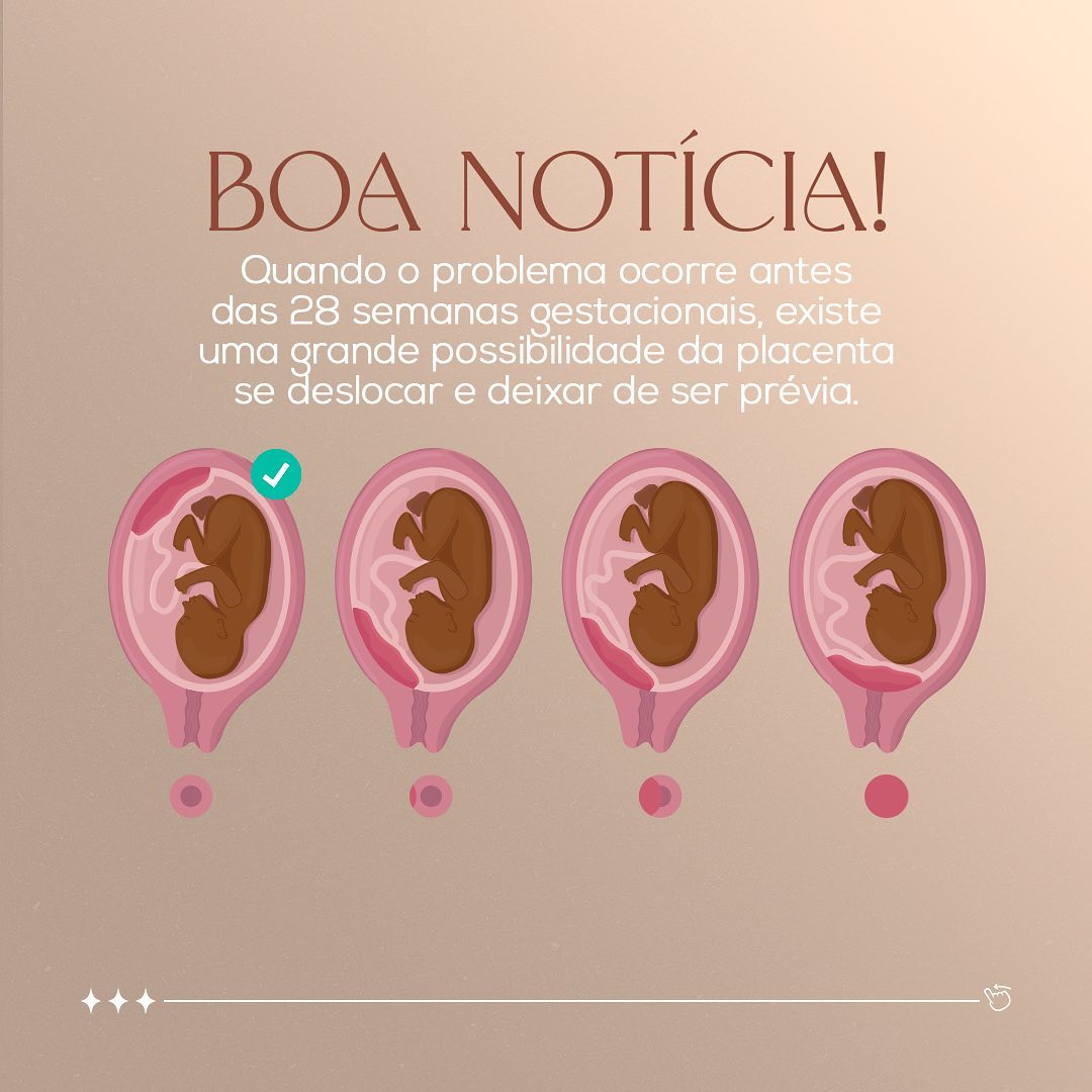 Você também recebeu o mesmo diagnóstico?
