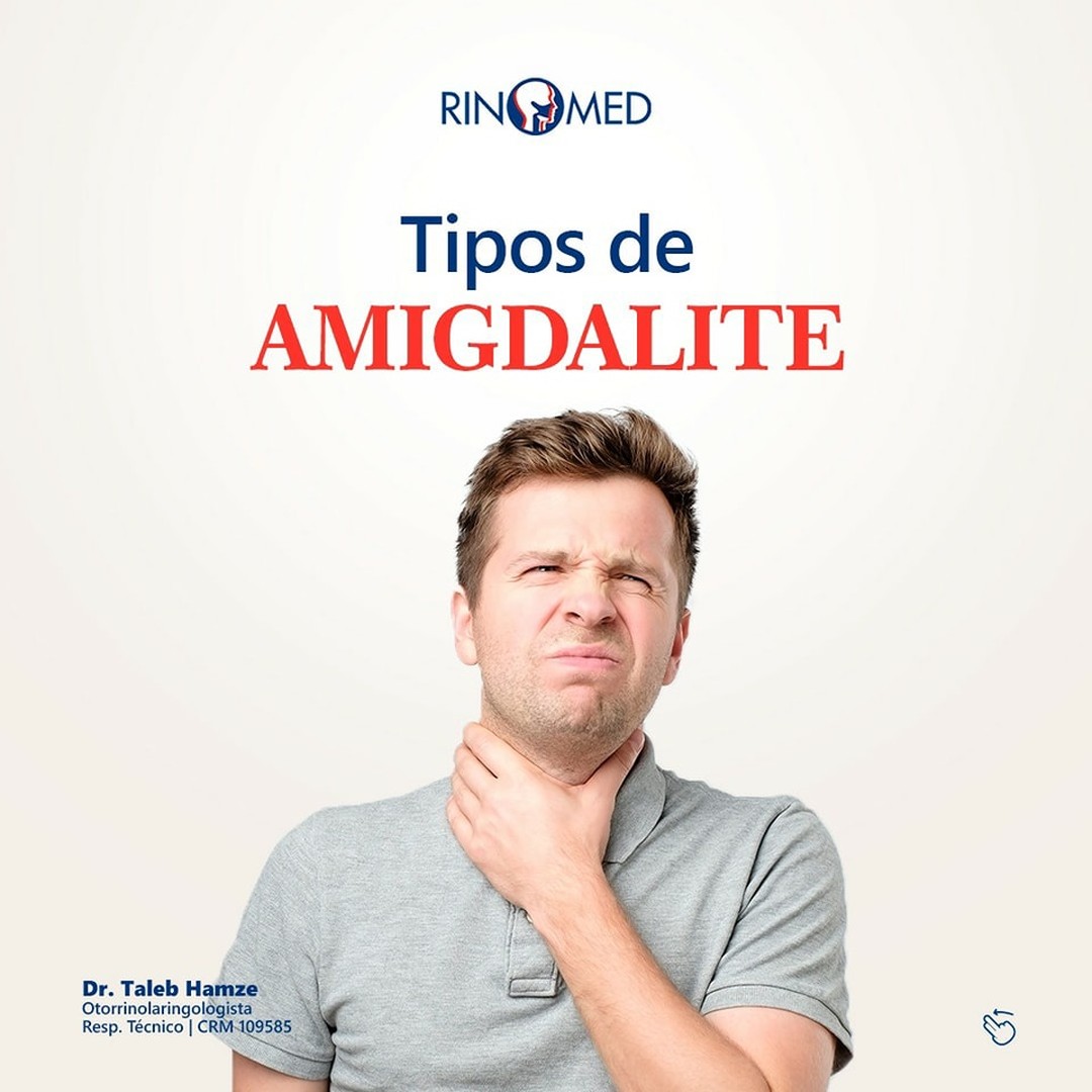 Tipos de Amigdalite?