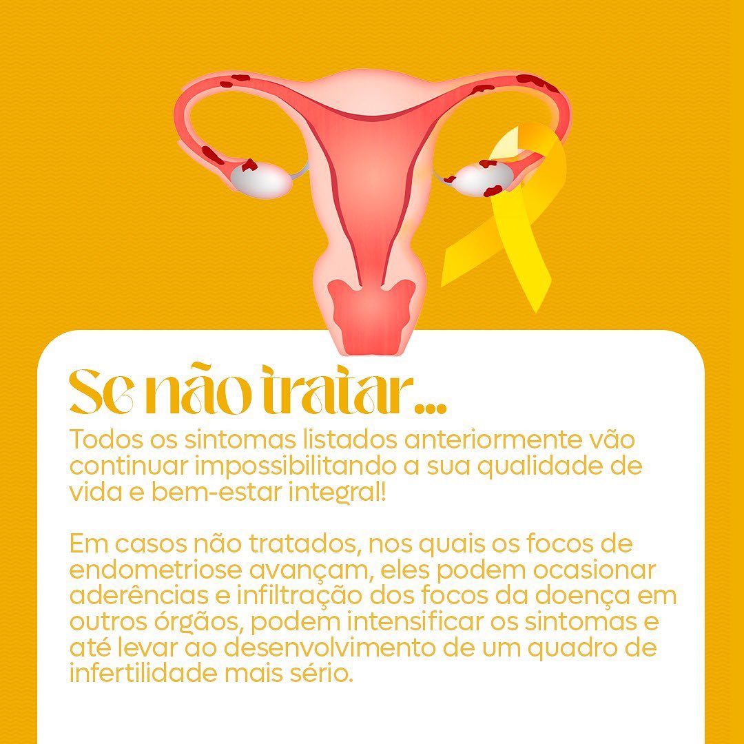 Vamos falar sobre endometriose?