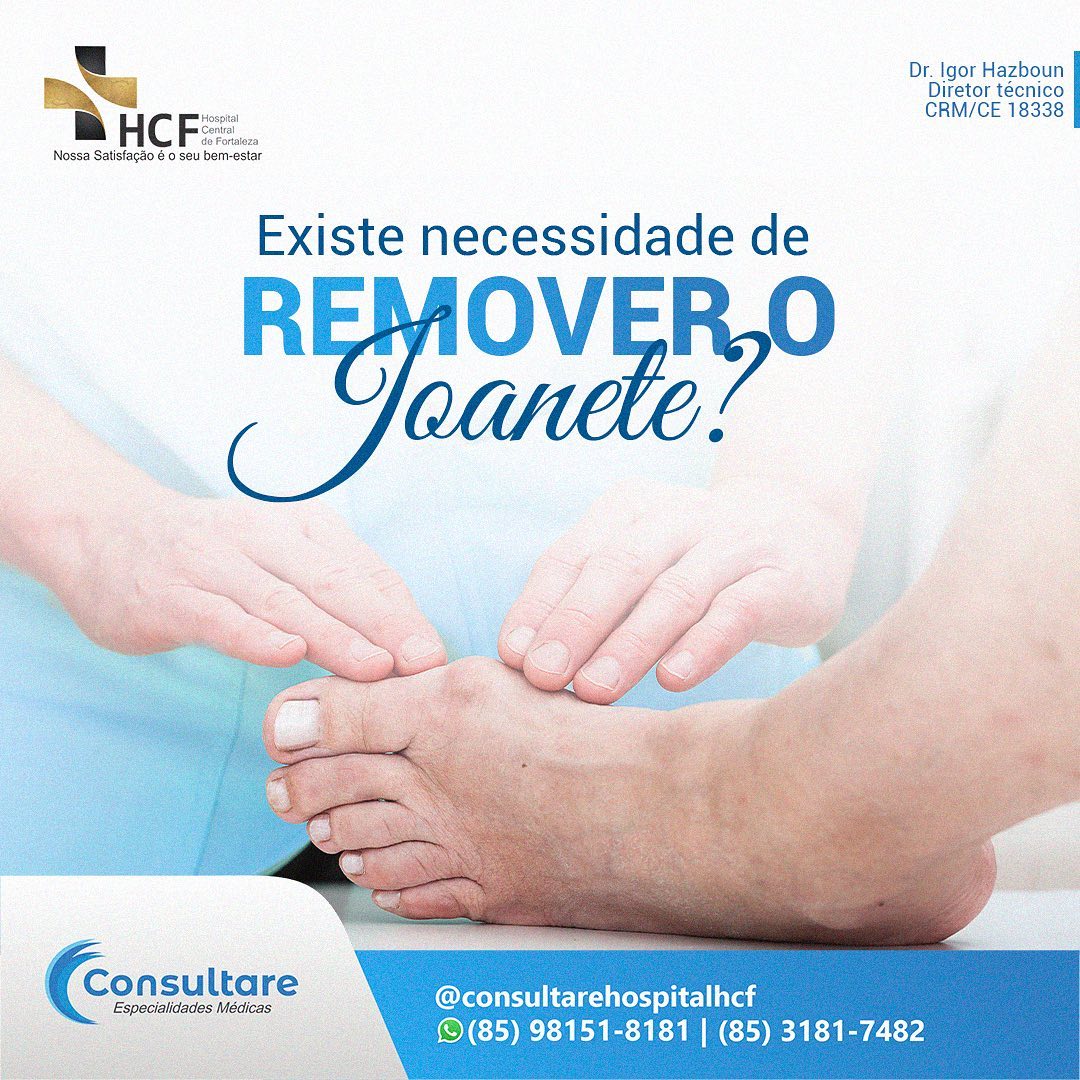 Existe necessidade de remover o joanete?
