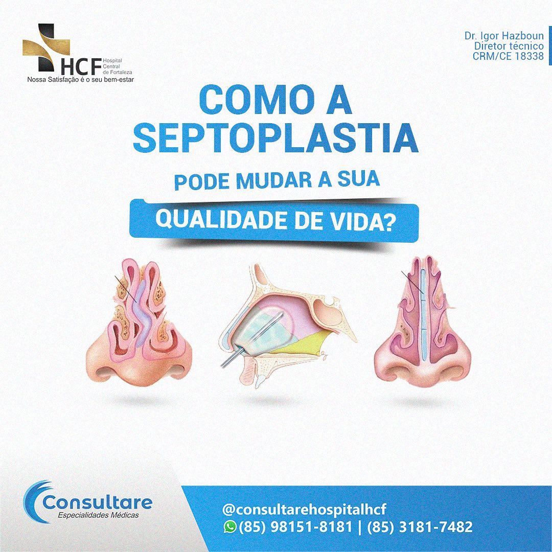 Dúvidas sobre a Septoplastia?