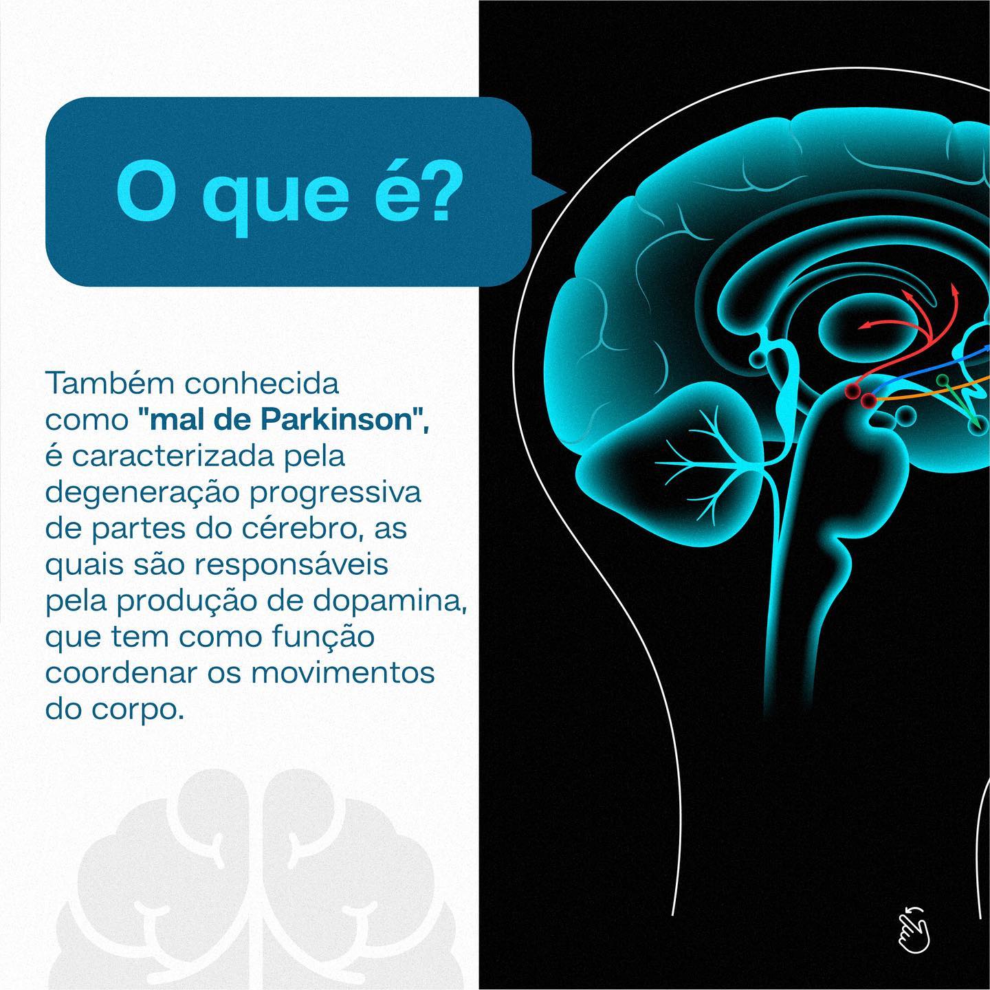 Você já conhecia as principais características da doença de Parkinson?