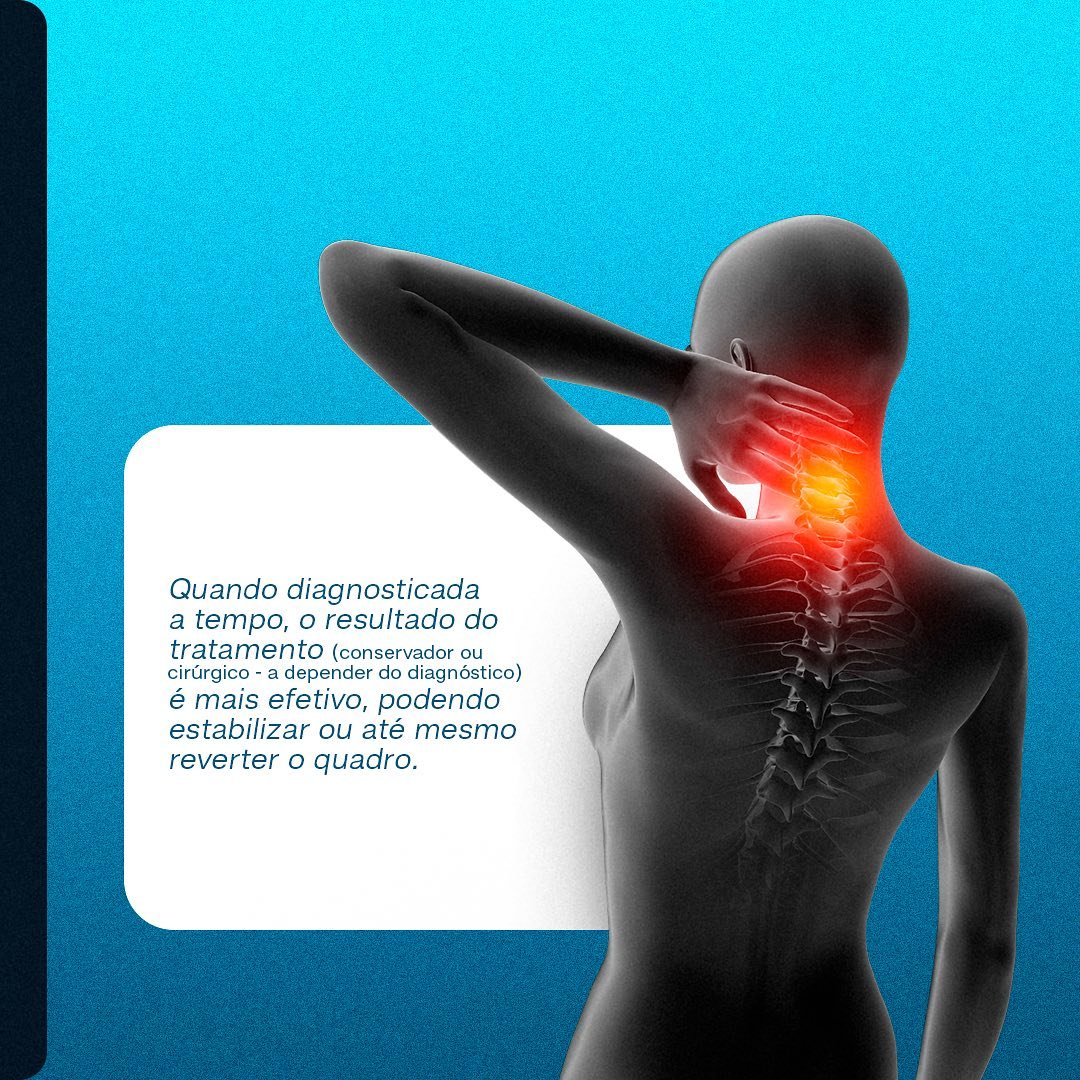 Você costuma sentir muitas dores e rigidez no pescoço?