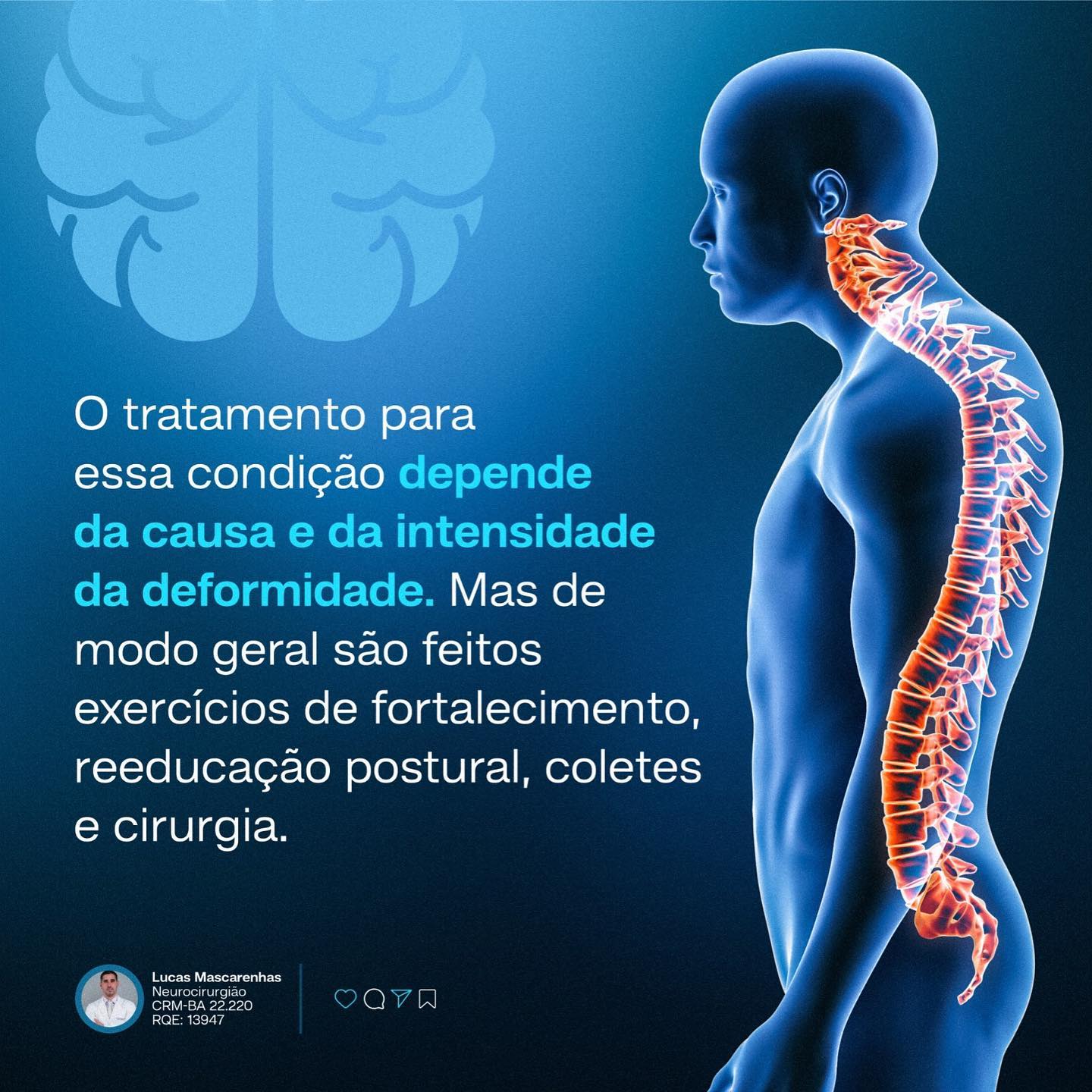 Você tem, ou conhece alguém com a coluna nessa posição?