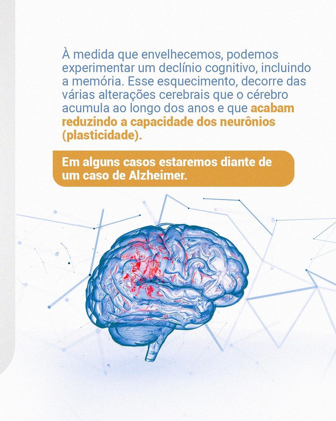 Esquecimento de nomes