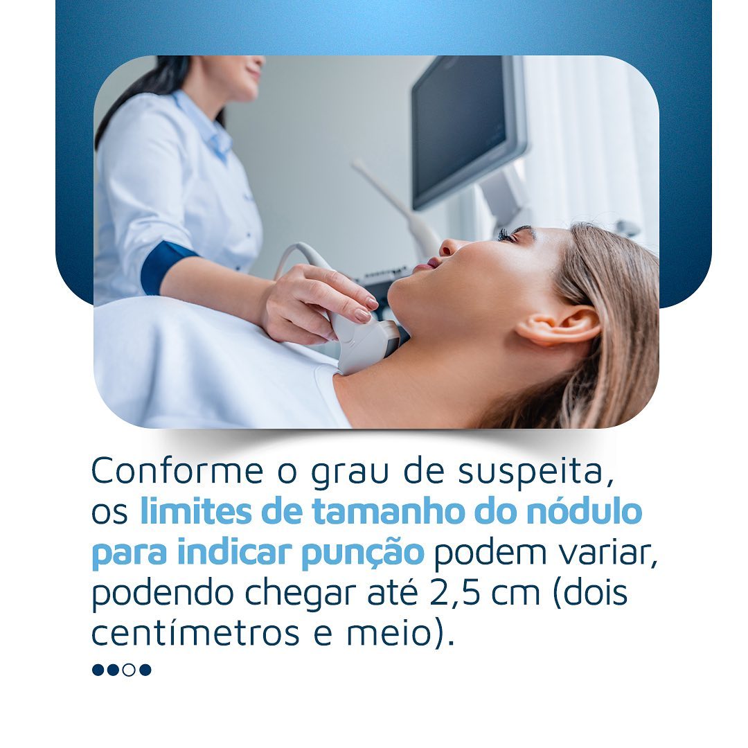Você sabia que nem todo nódulo precisa de punção?