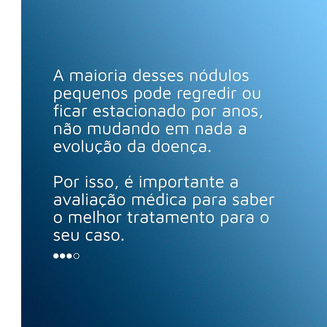 Você sabia que nem todo nódulo precisa de punção?