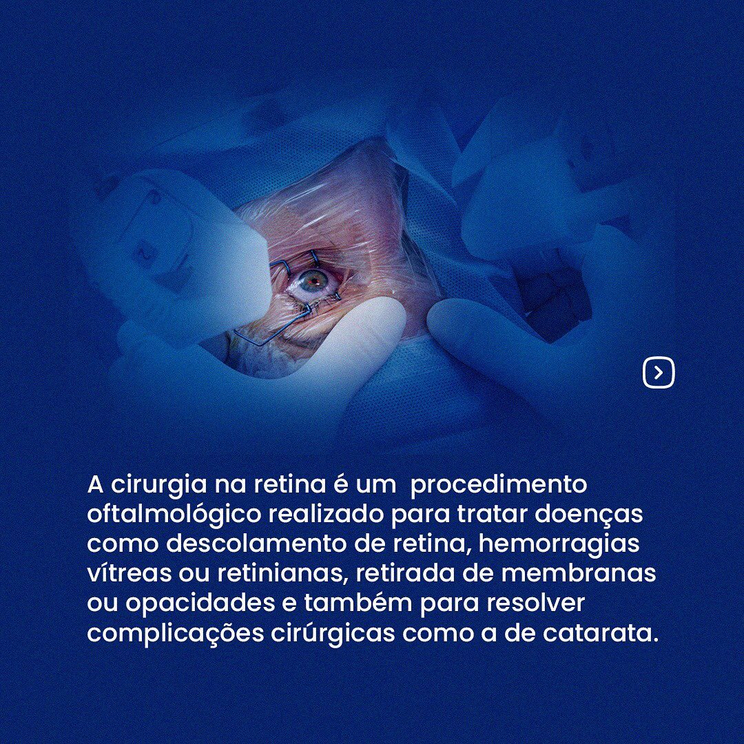 Cirurgia de Retina saiba como é feita!