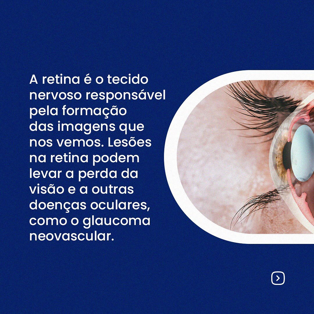 Cirurgia de Retina saiba como é feita!