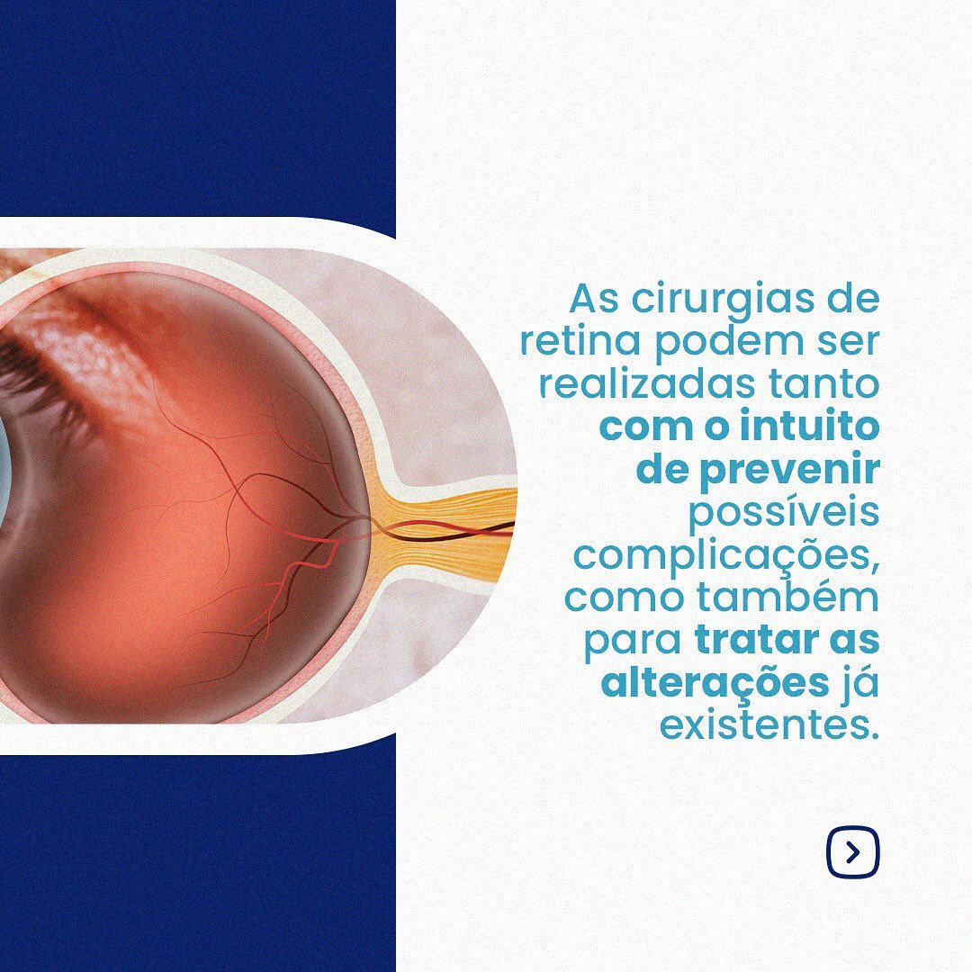 Cirurgia de Retina saiba como é feita!