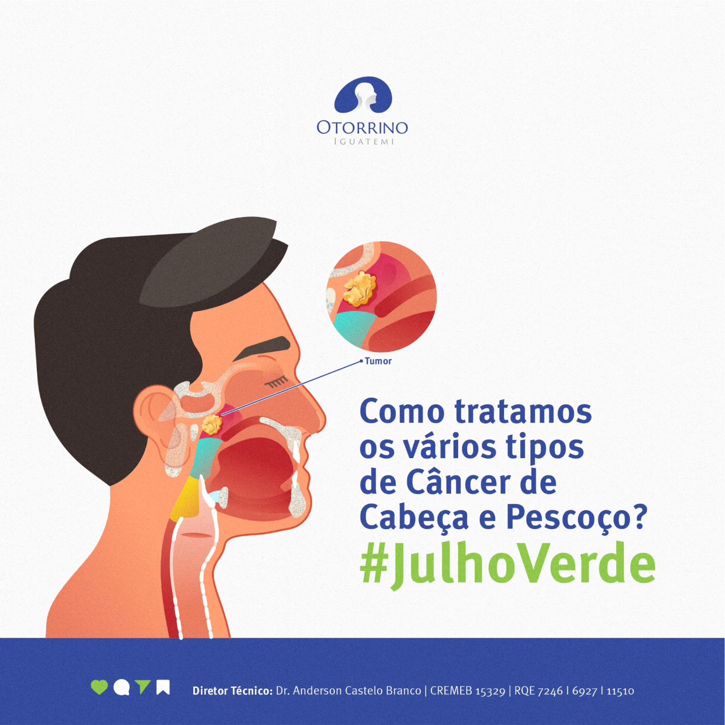 Conte com a Otorrino Iguatemi para a prevenção, diagnóstico precoce e tratamento do Câncer de Cabeça e Pescoço.