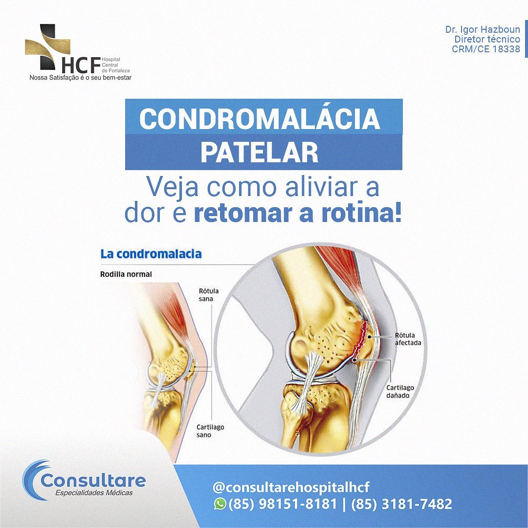 Você sente desconforto no joelho? Busque ajuda do seu ortopedista!