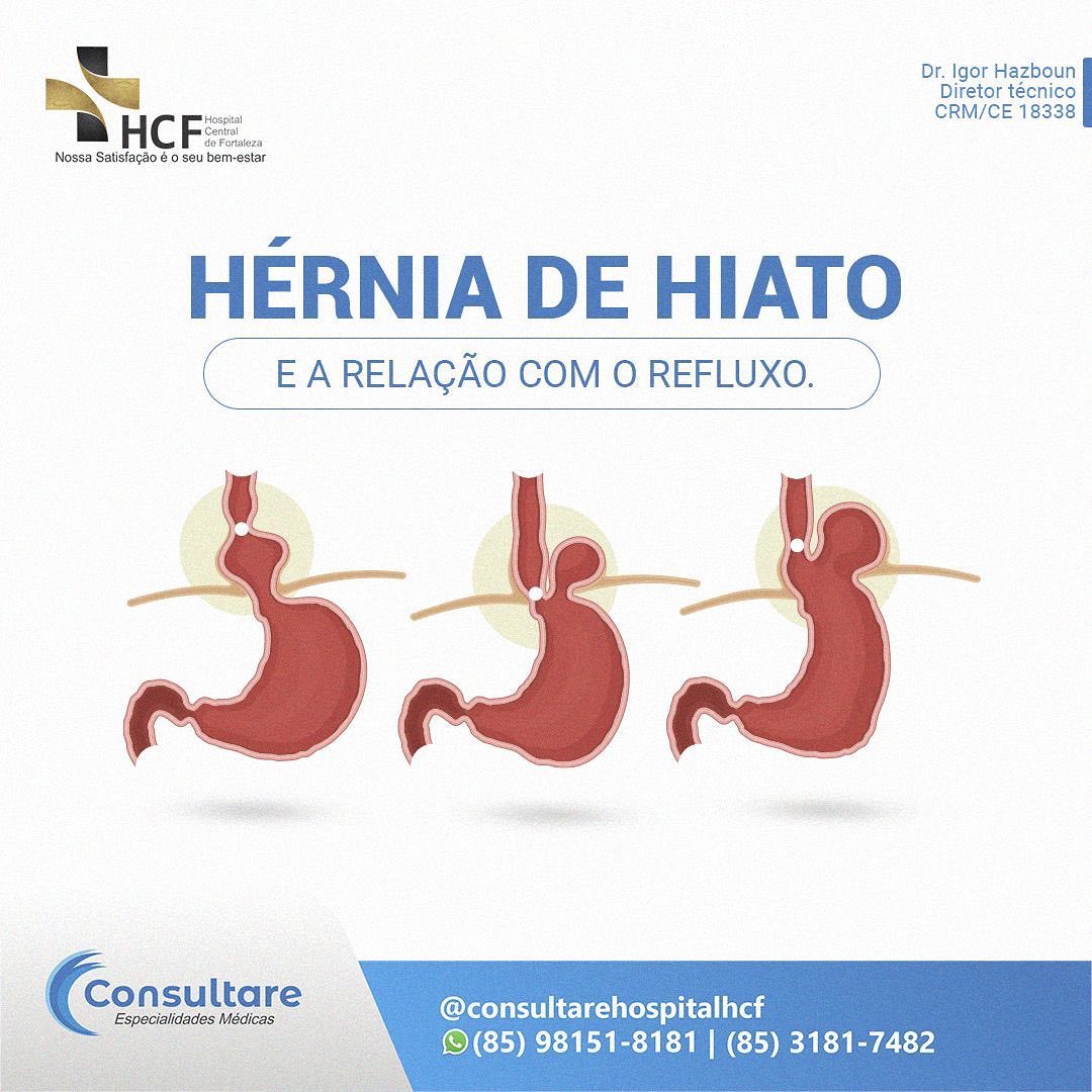 Existem dois tipos de hérnia de hiato.