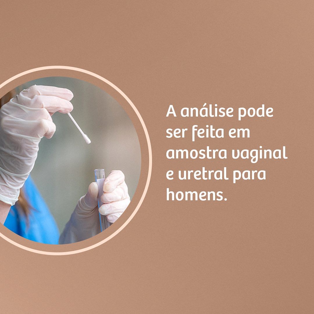 Você já realizou esse exame?