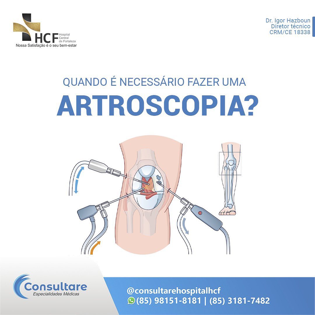 Artroscopia  quando é necessário fazer?