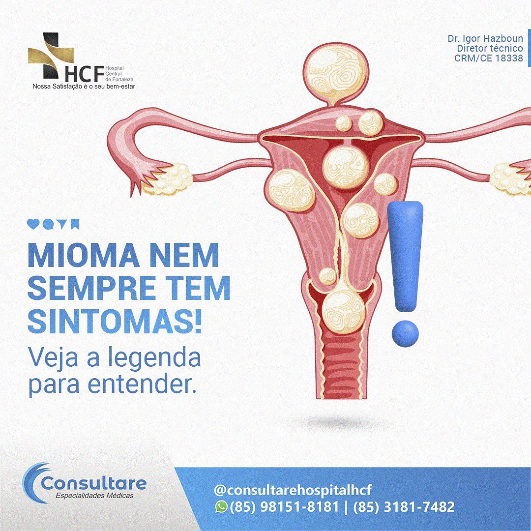 Já sabia que existem miomas que não causam sintomas?