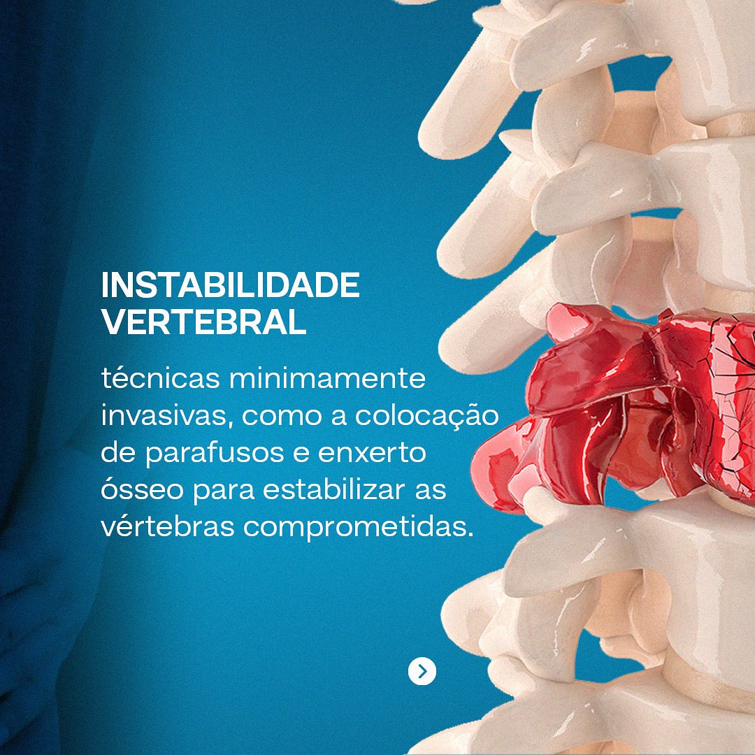 A consulta é ideal para saber se esse tipo de cirurgia é indicado para você!