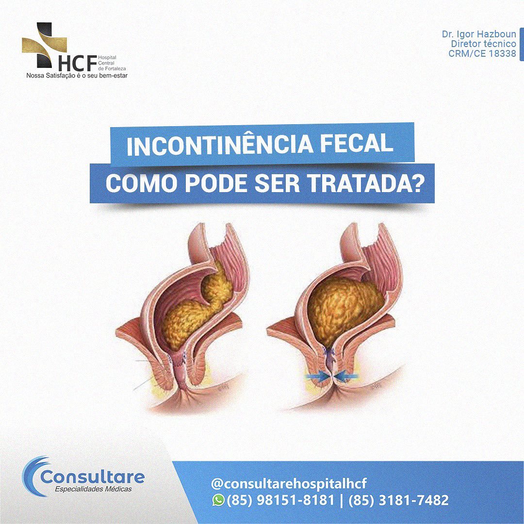 Incontinência fecal como pode ser tratada?