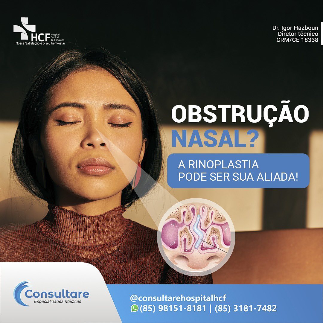 Quer descobrir se o seu caso necessita de uma septoplastia? Consulte seu otorrino!